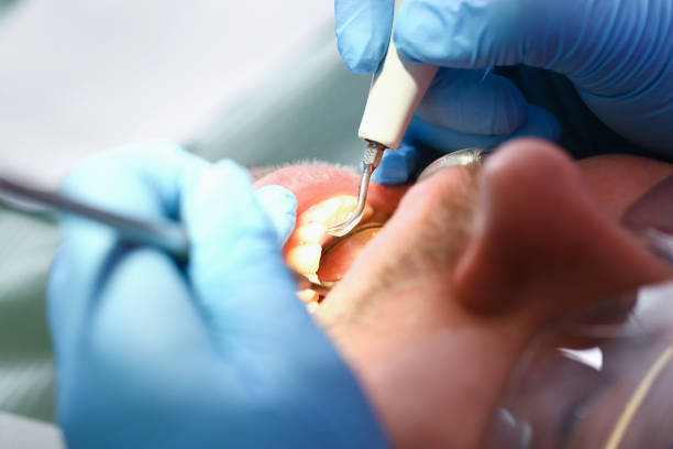 Best Emergency Denture Repair in Portsmouth, VA