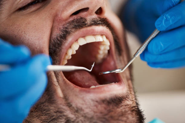 Best Walk-In Emergency Dental Services in Portsmouth, VA