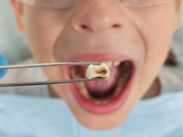 Best Emergency Care for Gum Disease in Portsmouth, VA